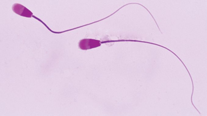 Sperm-cells