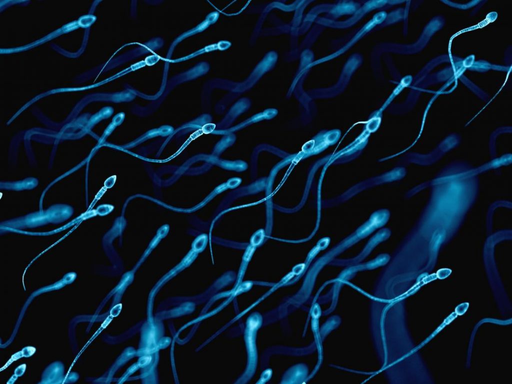 What causes semen to be of different color? Know These Facts Health ... image What causes semen to be of different color? Know These Facts Health ...