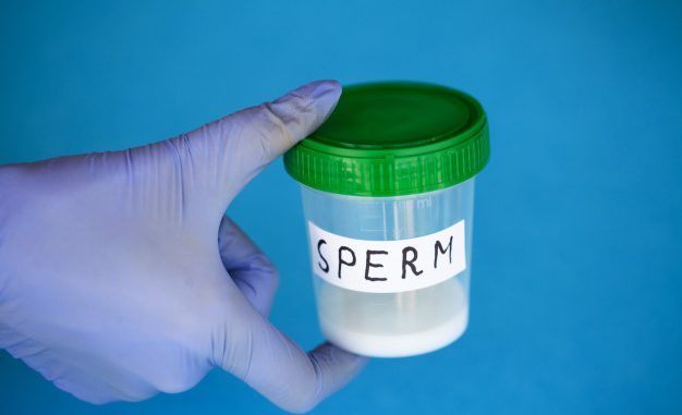 health-sperm-analysis-concept-bank-sperm-infertility-doctor-s-hand-holding-container-analyzes_118454-1640
